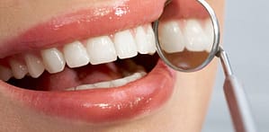 dental checkup